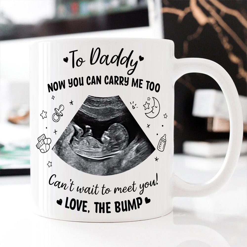 Personalized Baby Ultrasound Photo To Daddy Now You Can Carry Me Too White Mug