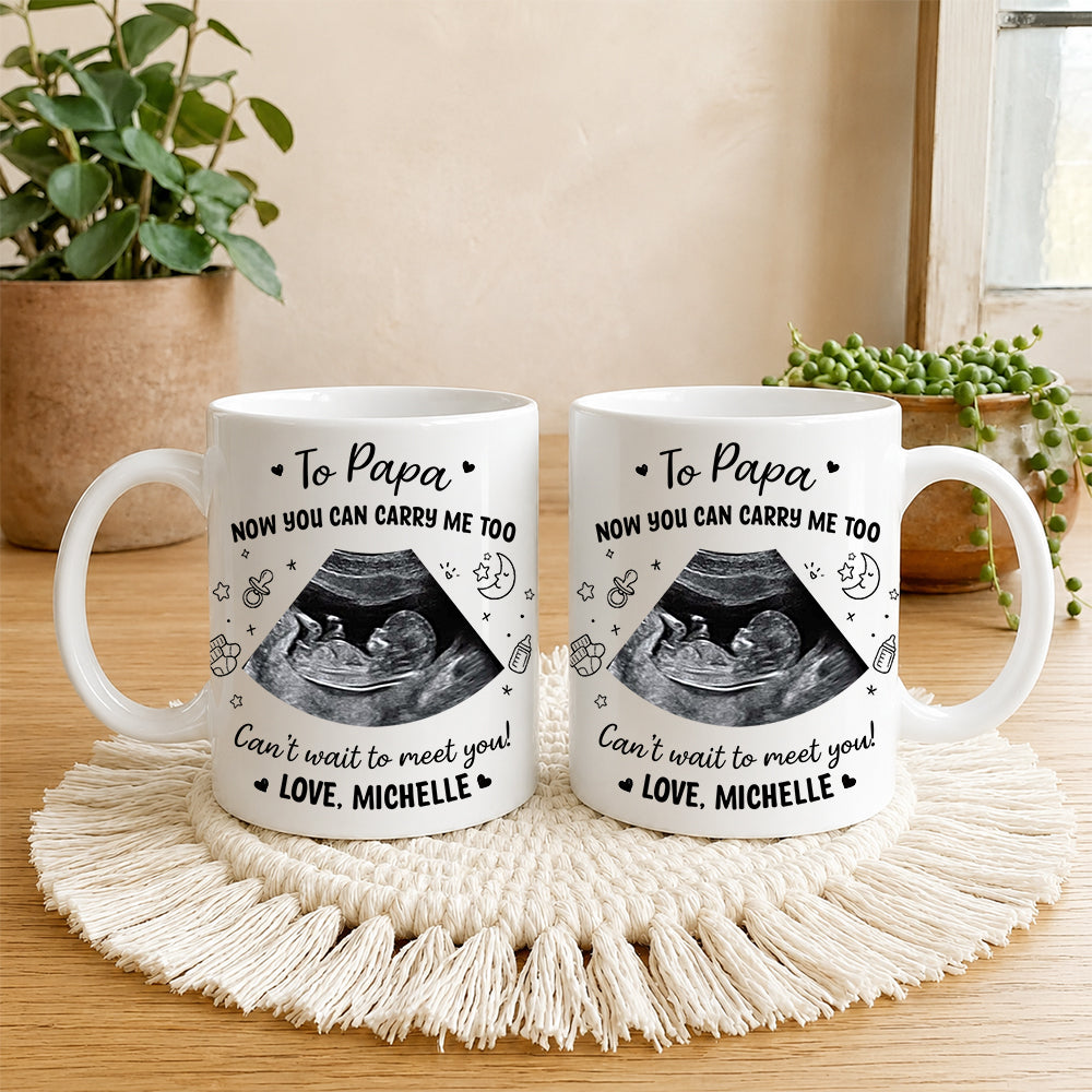 Personalized Baby Ultrasound Photo To Daddy Now You Can Carry Me Too White Mug