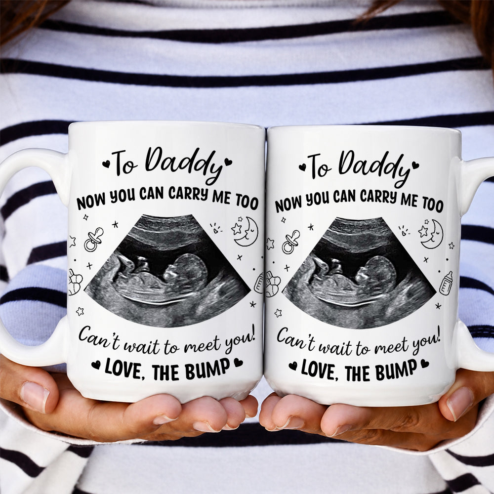 Personalized Baby Ultrasound Photo To Daddy Now You Can Carry Me Too White Mug
