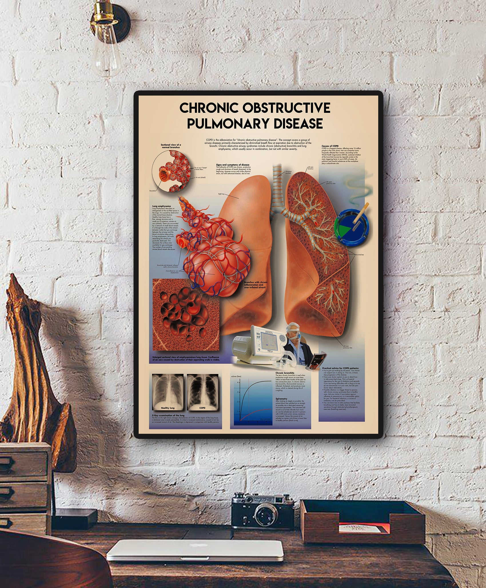 Chronic Obstructive Pulmonary Disease Standard Poster
